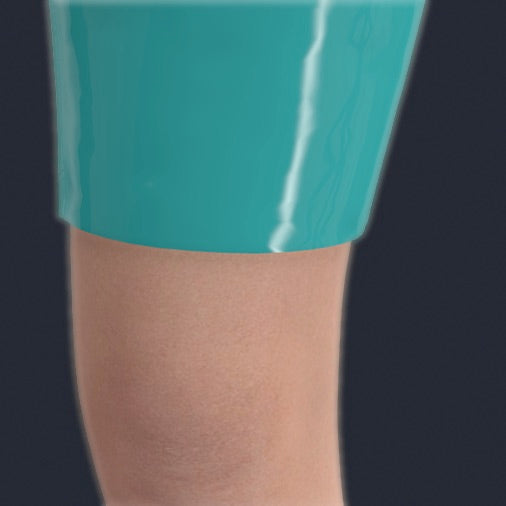 Legs